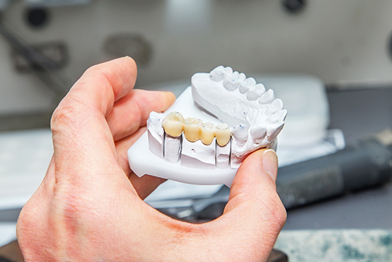 Laurel Bowie Implant and Cosmetic Dentistry | Night Guards, Ceramic Crowns and Root Canals