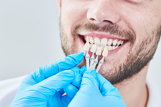 Laurel Bowie Implant and Cosmetic Dentistry | Root Canals, Teeth Whitening and Implant Restorations