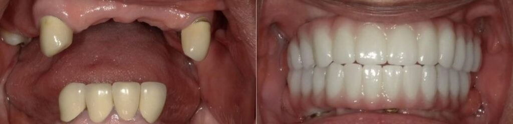 Laurel Bowie Implant and Cosmetic Dentistry | Dentures, Oral Exams and Root Canals