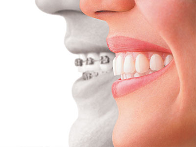 Laurel Bowie Implant and Cosmetic Dentistry | Laser Dentistry, Cosmetic Dentistry and Oral Exams