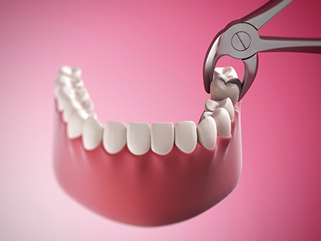 Laurel Bowie Implant and Cosmetic Dentistry