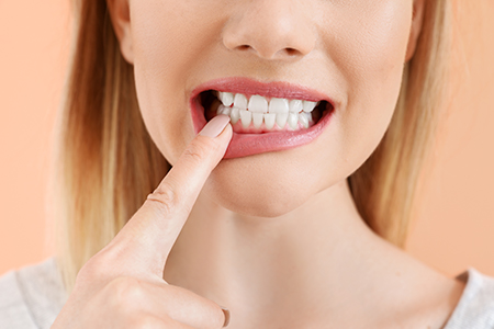 Laurel Bowie Implant and Cosmetic Dentistry